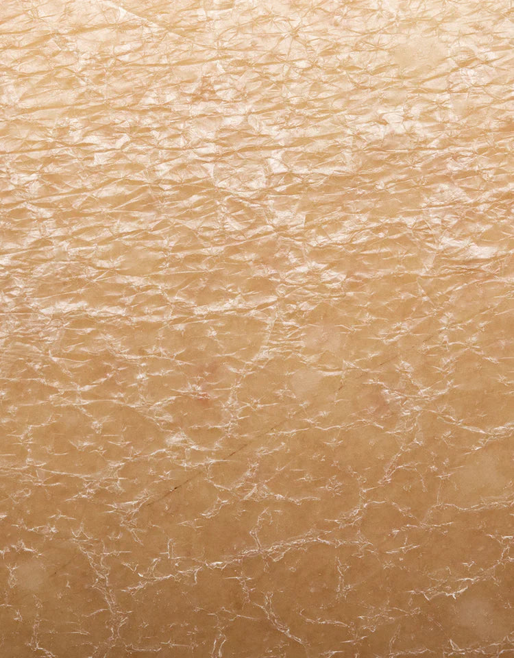 Droge Huid/Lichaamsbalans Herstellen