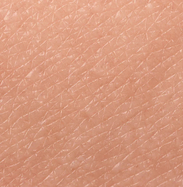 Droge/Geïrriteerde Huid